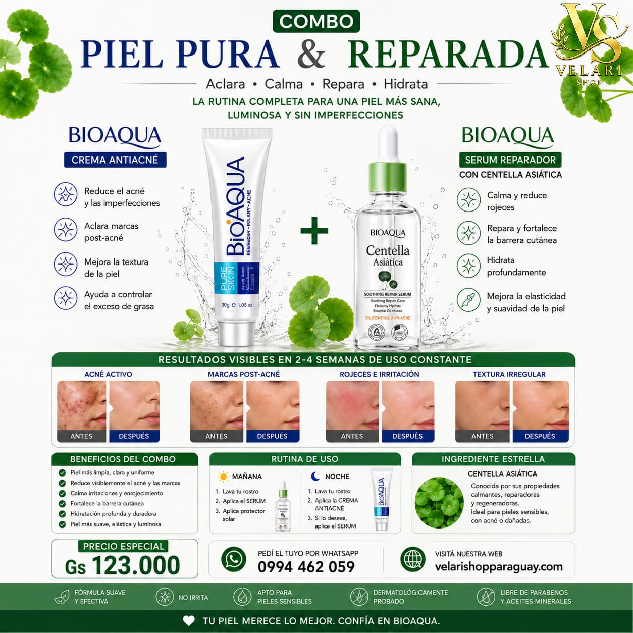 Kit Facial Bioaqua Antiacné + Sérum Reparador con Centella Asiática